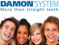 Damon Braces